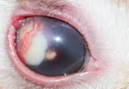 UVEITIS