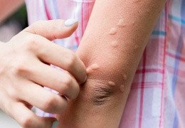 ¿EXISTEN LOS CONEJOS HIPOALERGÉNICOS?